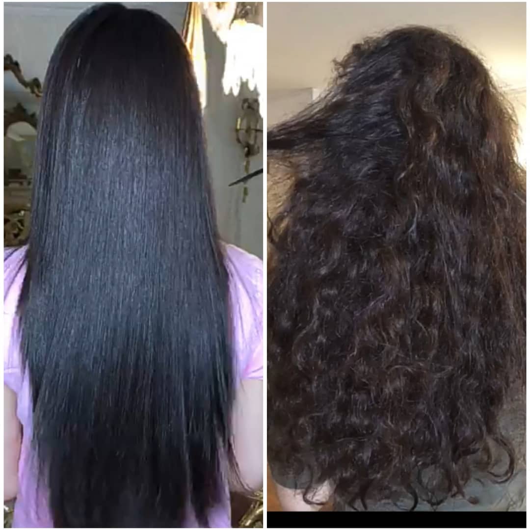 قبل و بعداز کراتینه