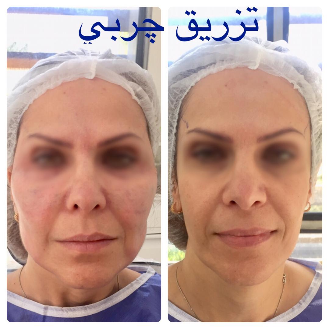 کلینیک زیبایی دکتر نسیم زمان