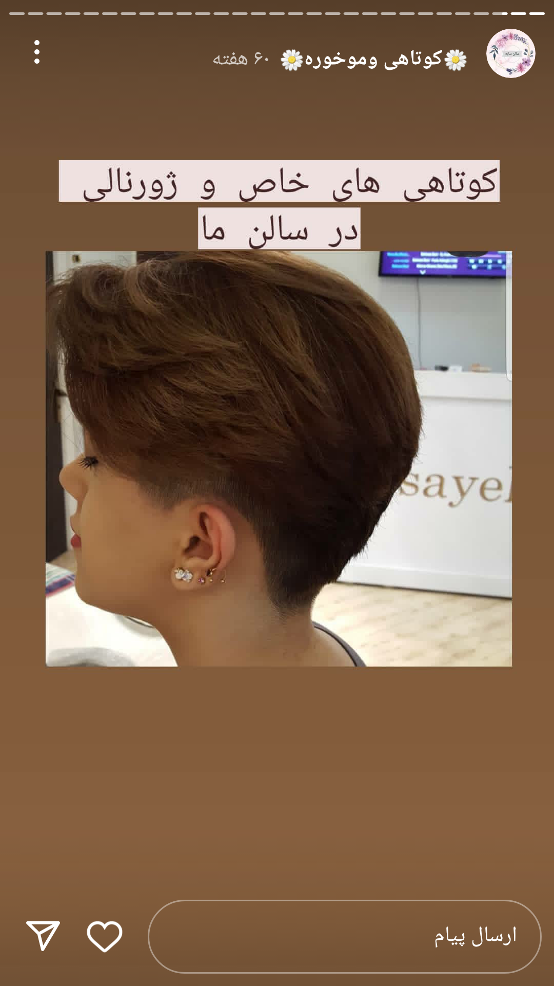 کوتاهی مو