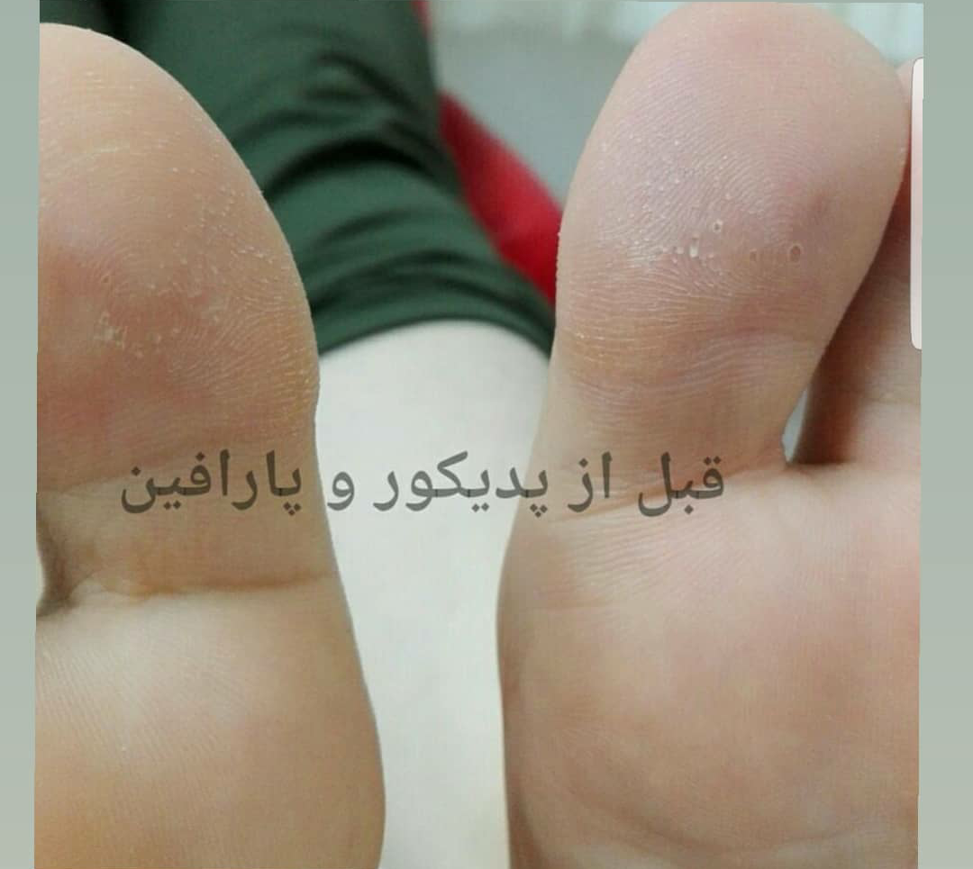 خدمات پا
