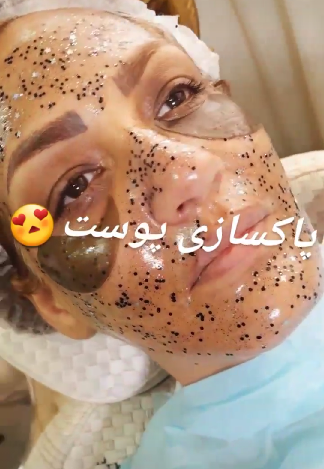 فشیال پوست