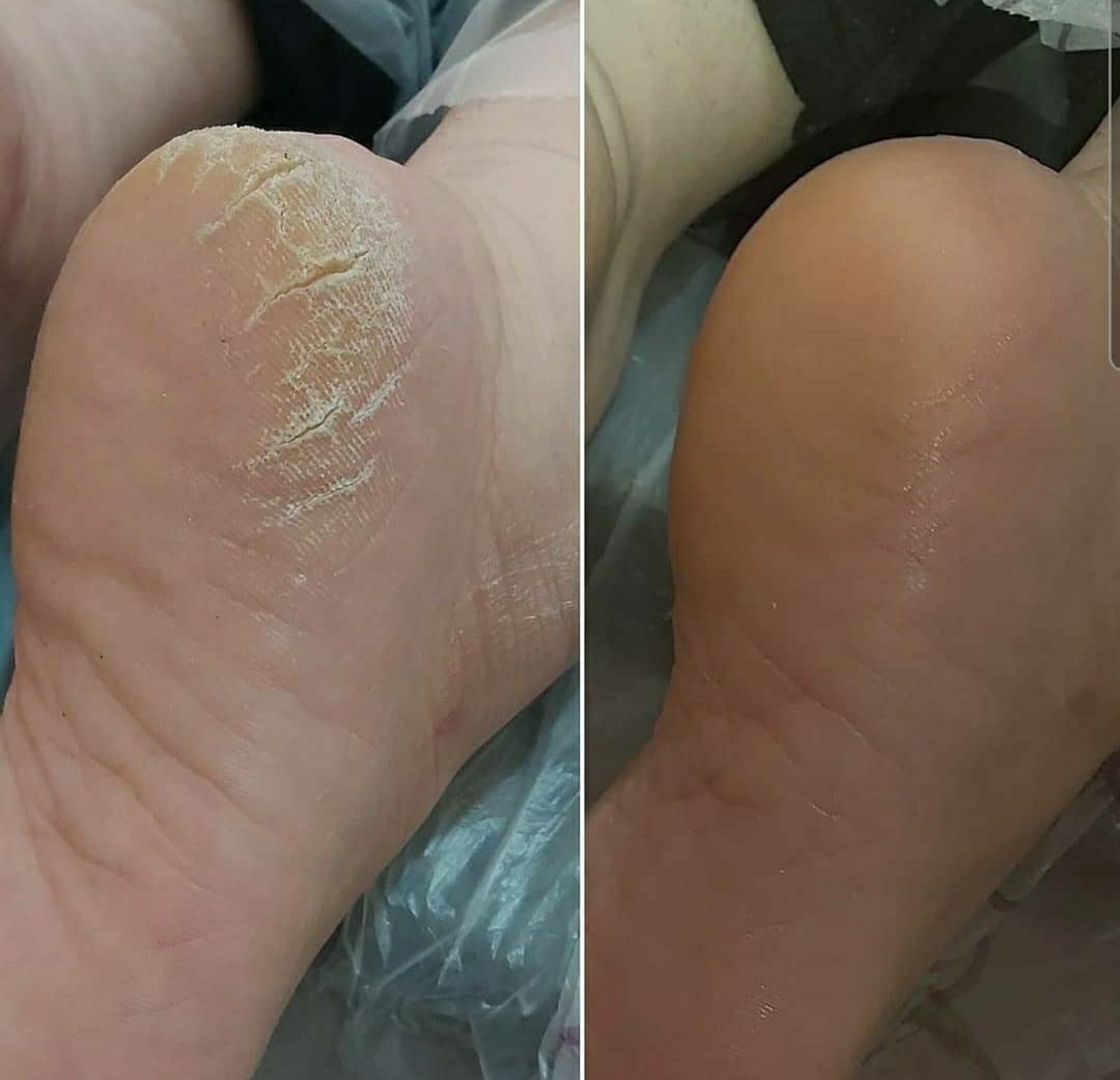 کفسابی و پدیکور