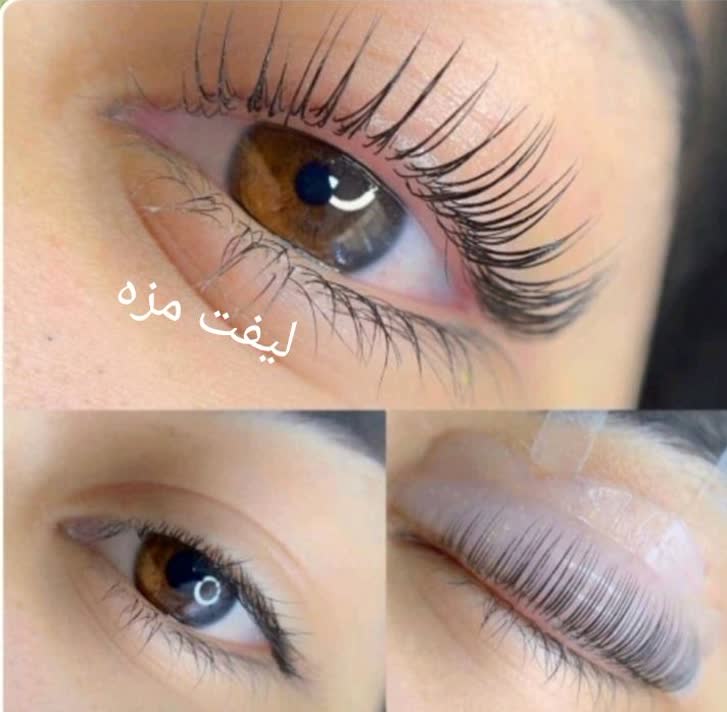 کاشت و لیفت ابرو