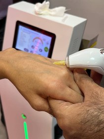 خرید اقساطی دستگاه کربوکسی تراپی