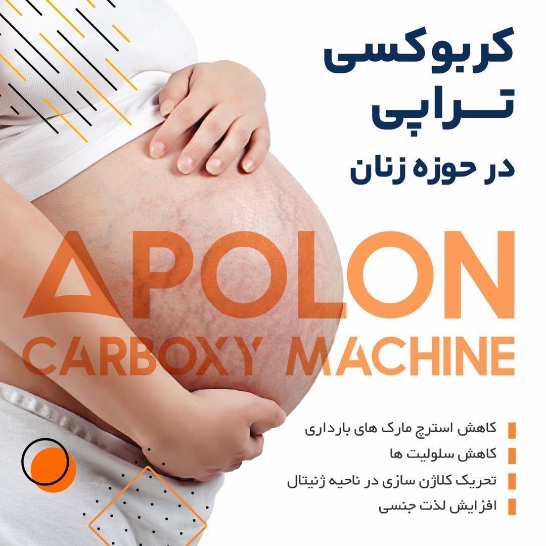 Apolon امکان خرید اقساطی دستگاه کربوکسی