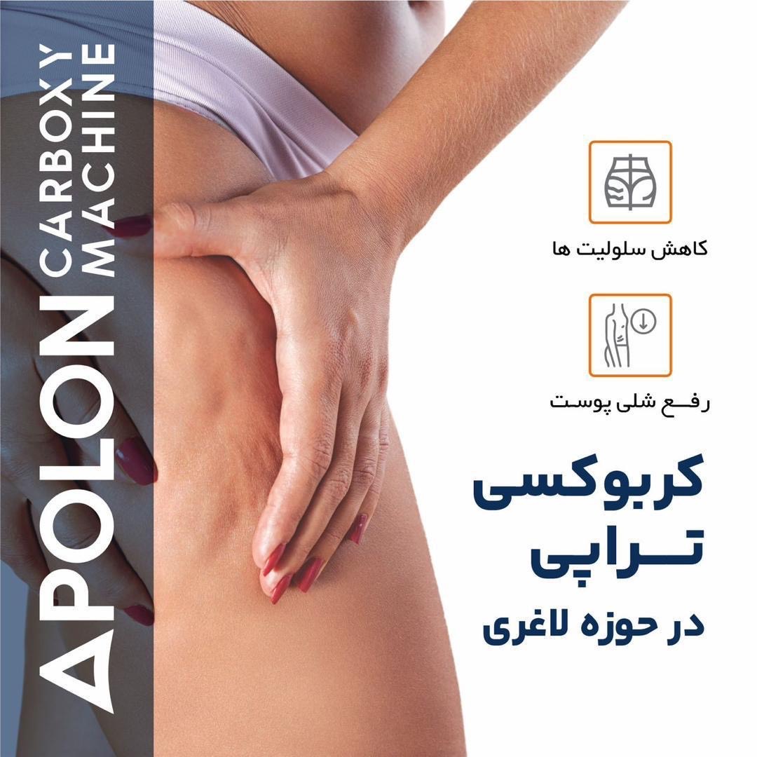 دستگاه کربوکسی