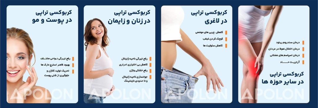 دستگاه کربوسی با گارانتی