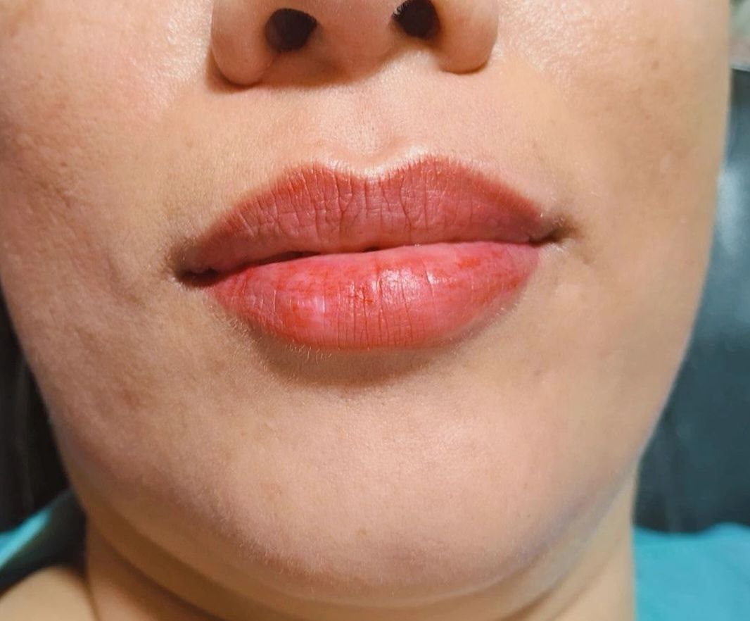 خدمات شیدینگ لب 🥰 برای دیدن نمونه کارهای بیشتر روی عکس کیلیک کنین ☝🏻