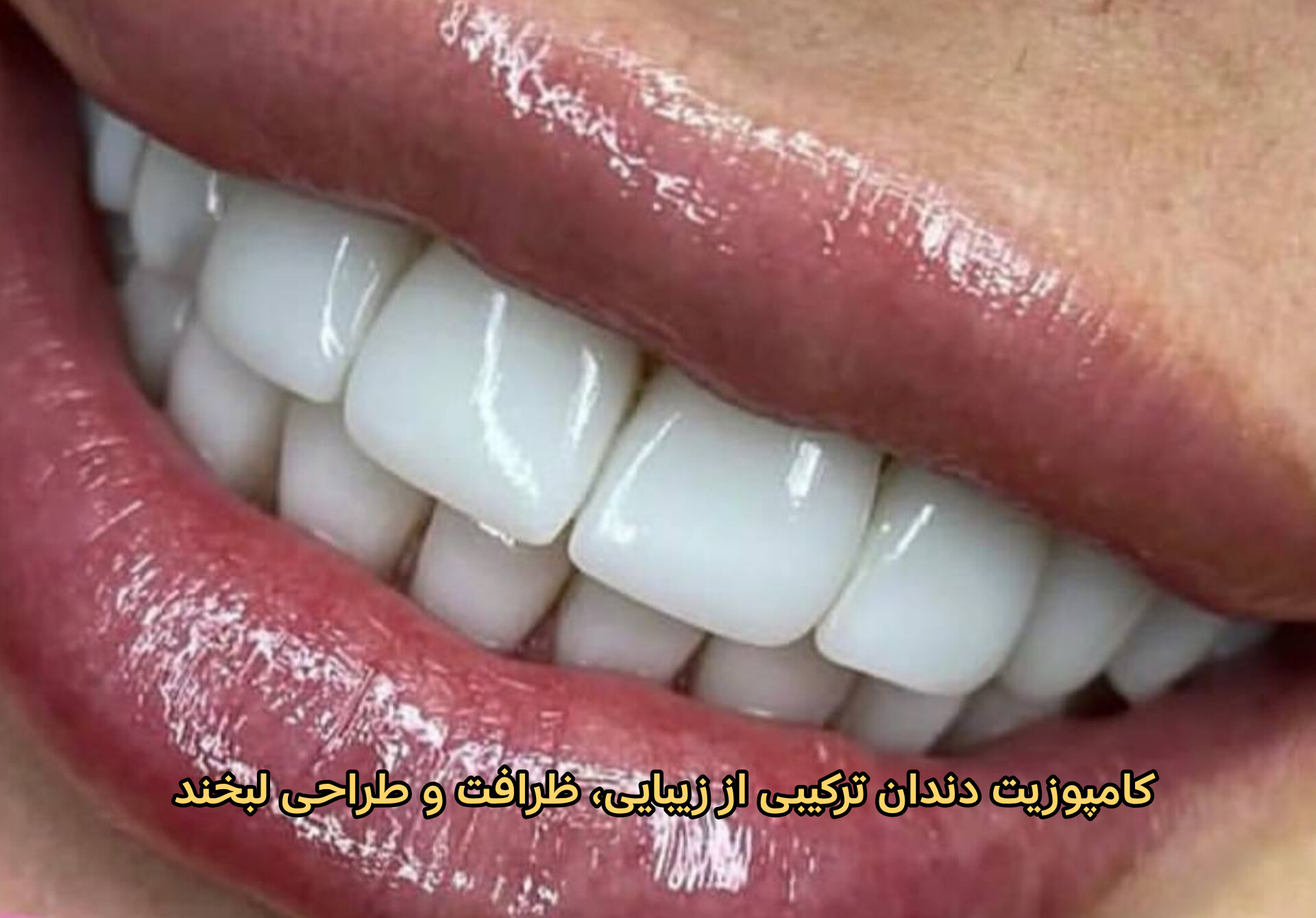 کامپوزیت