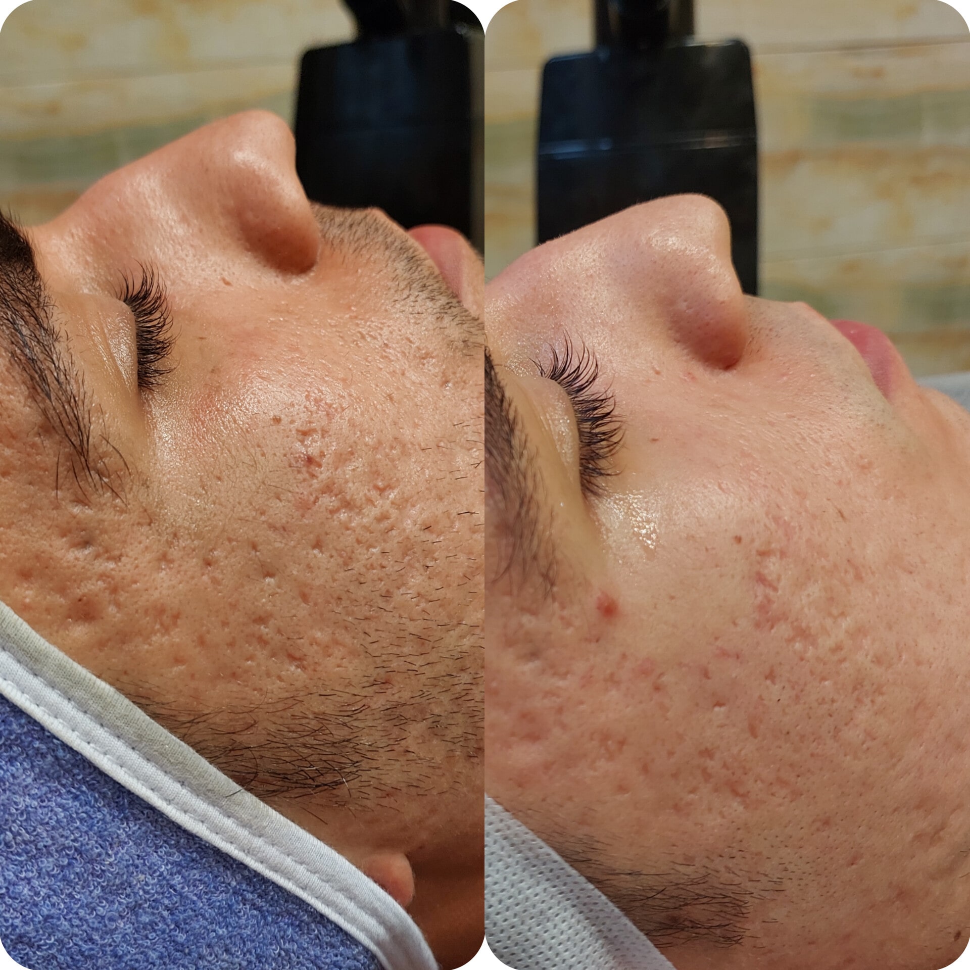 مرکز پاکسازی پوست یاس