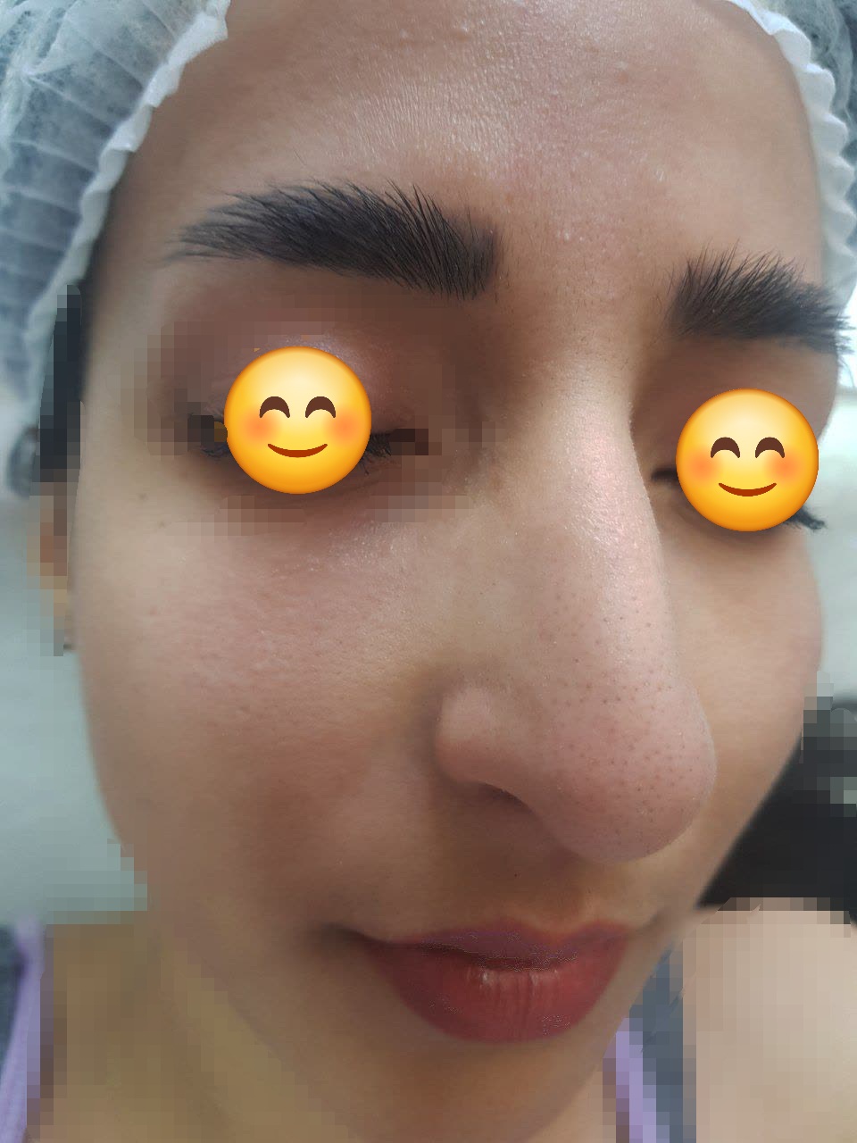 پاکسازی و لایه برداری