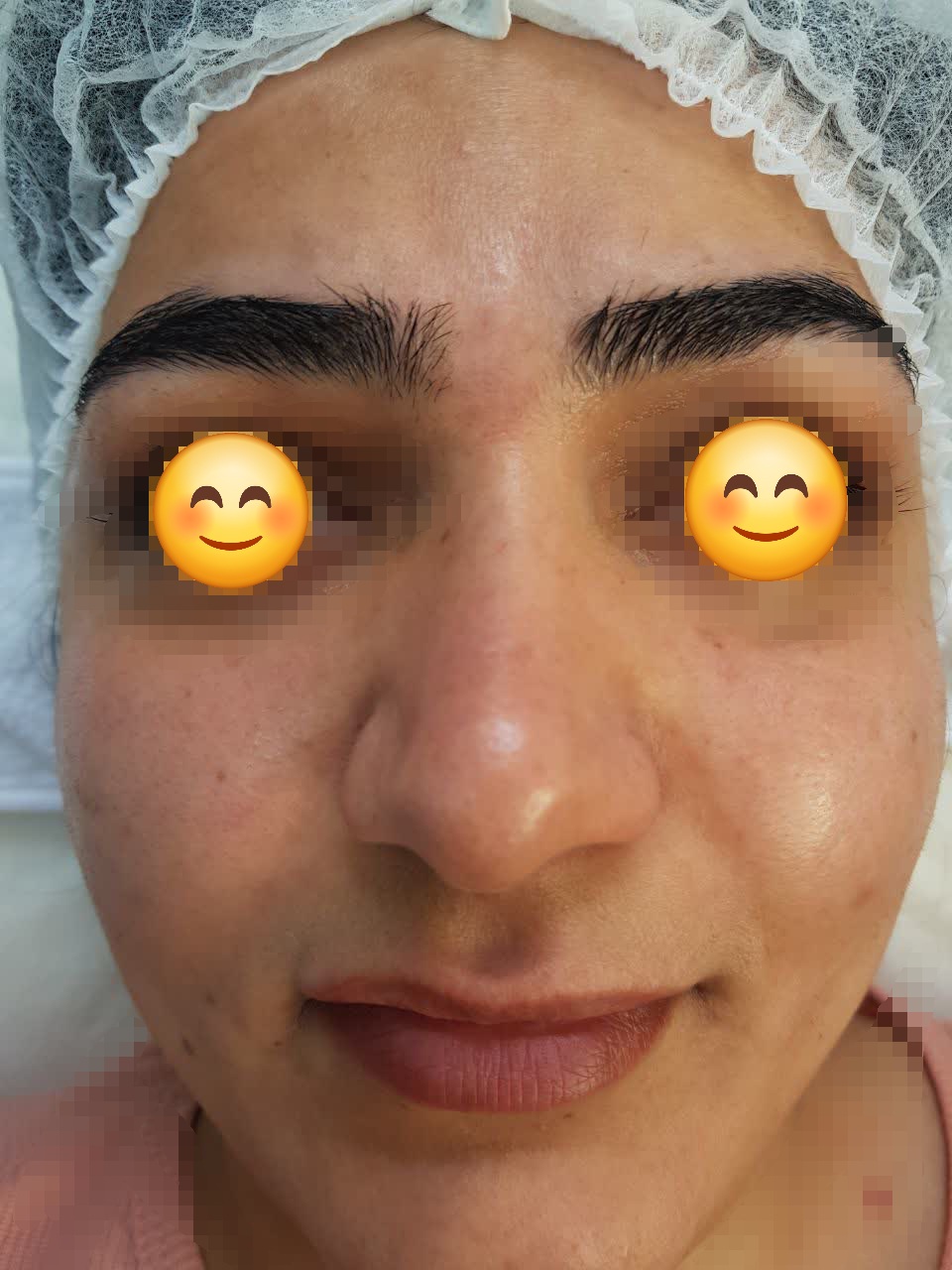 فشیال تخصصی پوست چرب