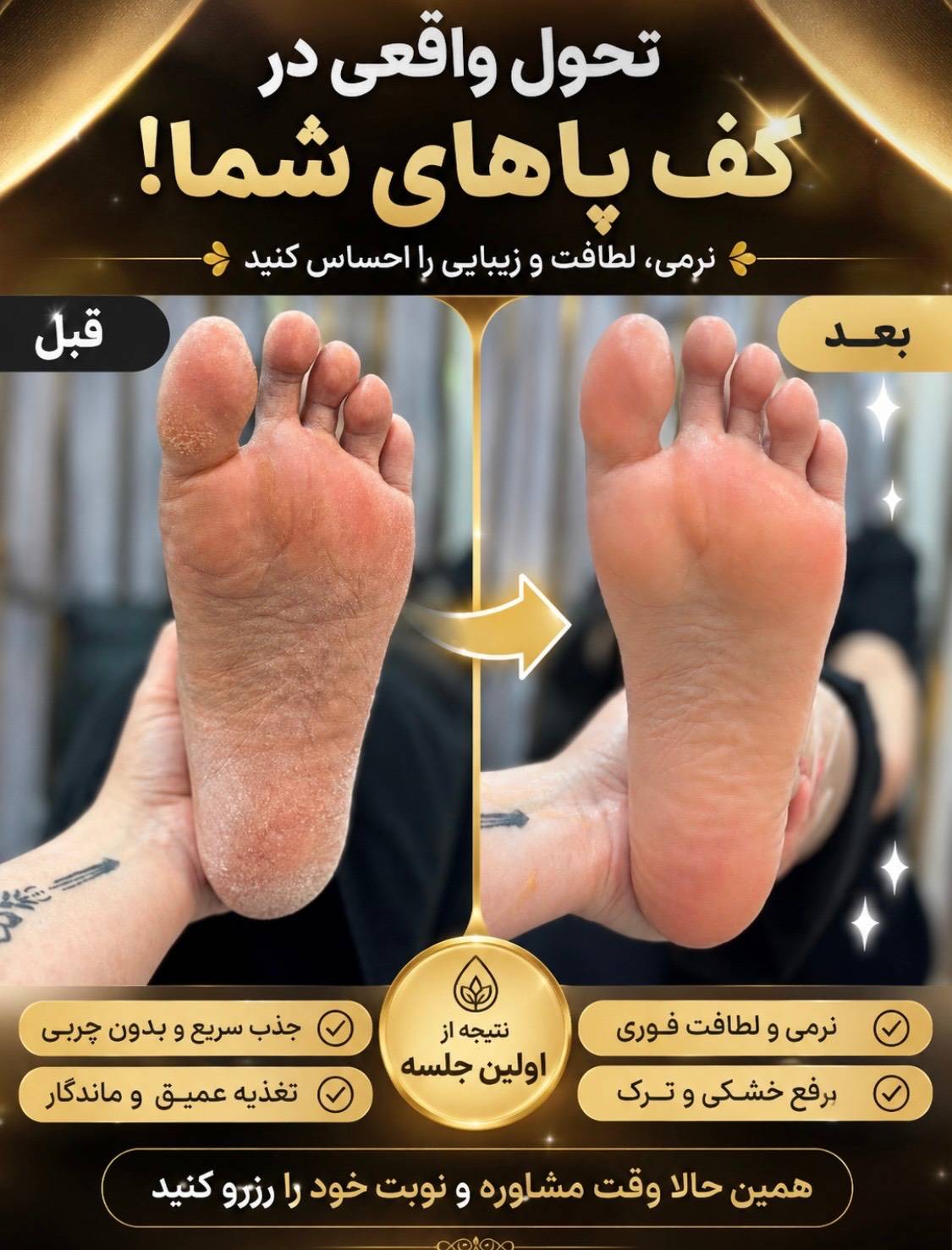 پدیکور