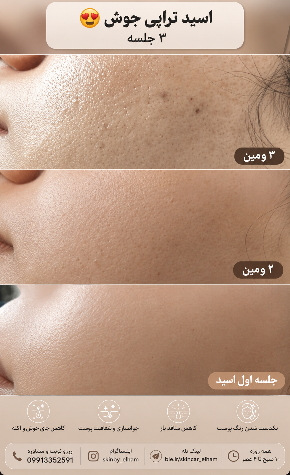 نمونه کار