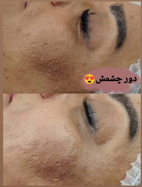 نمونه کار