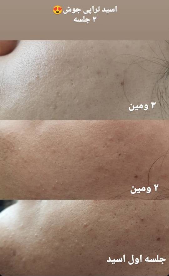 نمونه کار