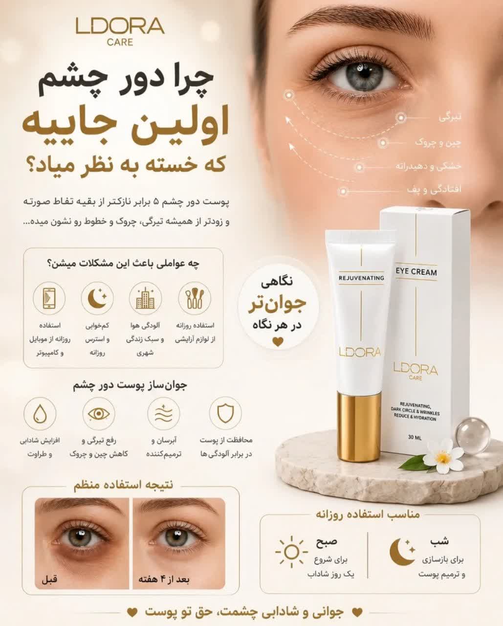 کرم دور چشم لدورا 