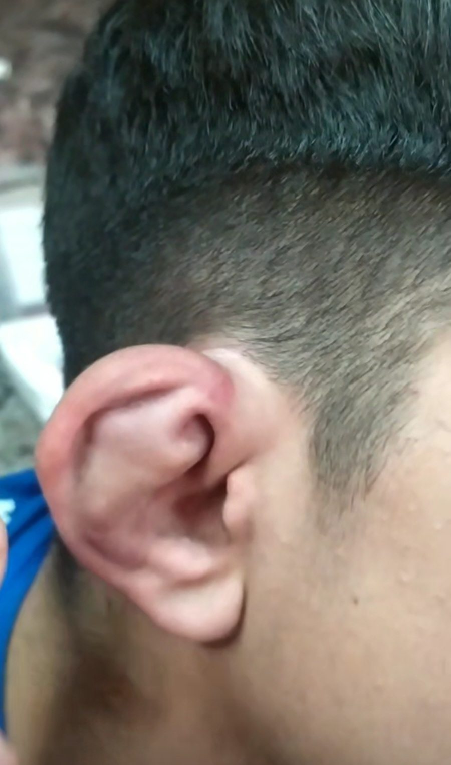 شکستن گوش