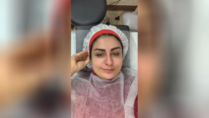 پاکسازی پوست صورت در اصفهان