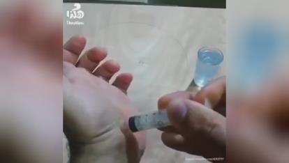 خارج کردن خار و خرده چوب از زیر پوست