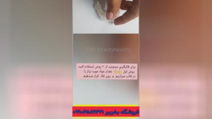 آموزش قالب‌ گیری لمینت متحرک دندان تورو اسمایل جنس اعلا