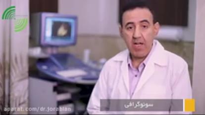 سونوگرافی تپش