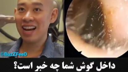 داخل گوشت چه خبره