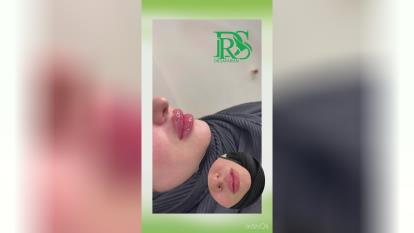 کلینیک زیبایی درمیس