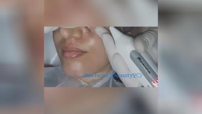 پلاسماجت