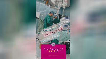 بهترین دکتر ابدومینوپلاستی