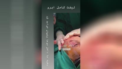 بهترین جراح ابدومینوپلاس