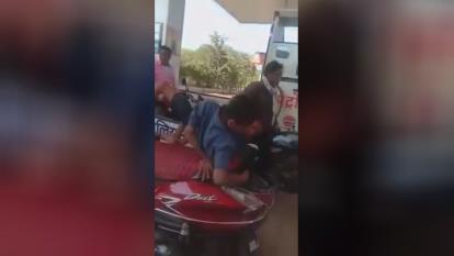 پسری که دو تن دریک بدن داشت