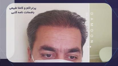 تیزر شماره سیزده