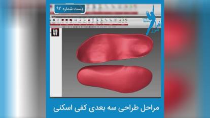 درمان صافی کف پا