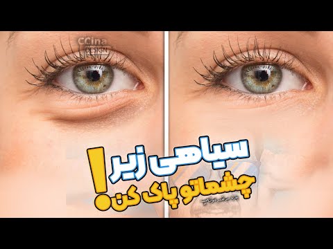 پوستر حذف آسان و طبیعی سیاهی زیر چشم با فتوشاپ 😎💙 سینا ایمانی