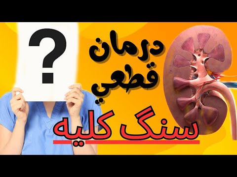 پوستر قطعی ترین درمان سنگ کلیه / سنگ کلیه درمان سریع
