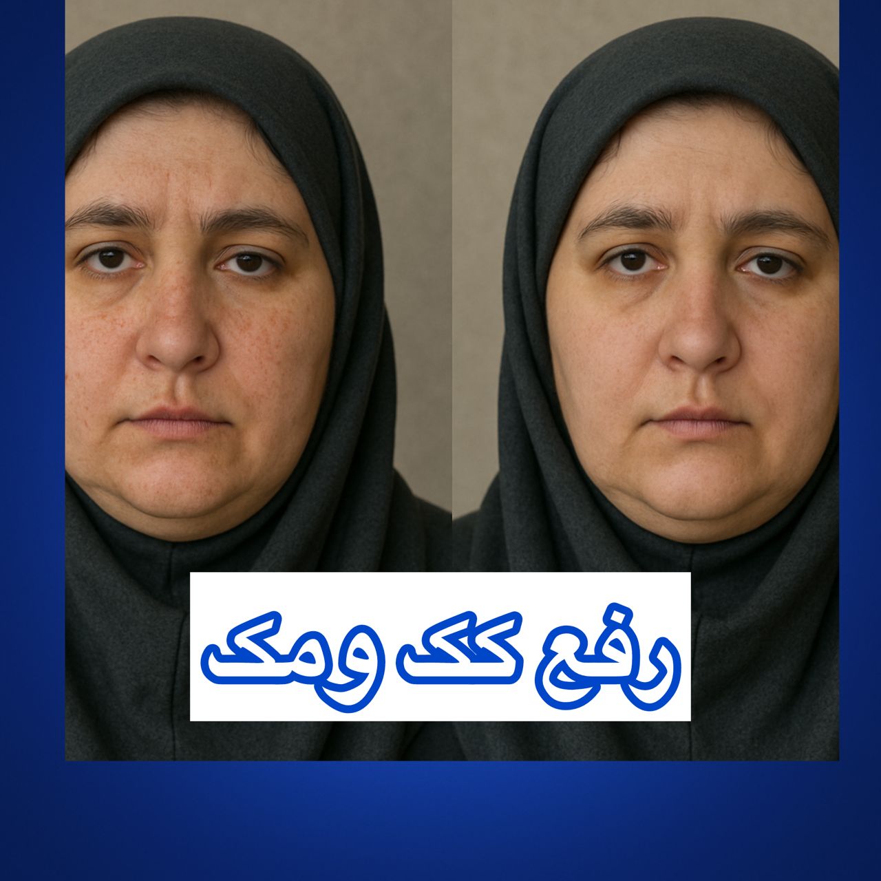 مرکز لیزر تاتو در تبریز
