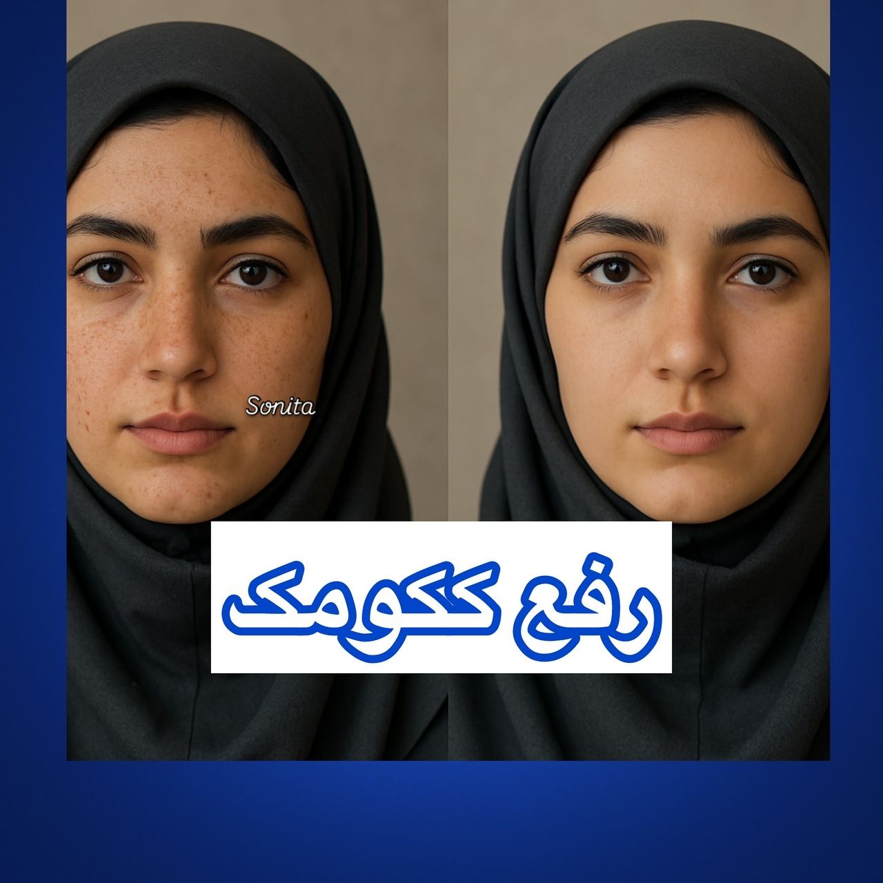 مرکز لیزر تاتو در تبریز
