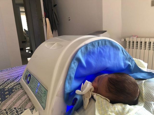 اجاره دستگاه زردی نوزاد در تجریش