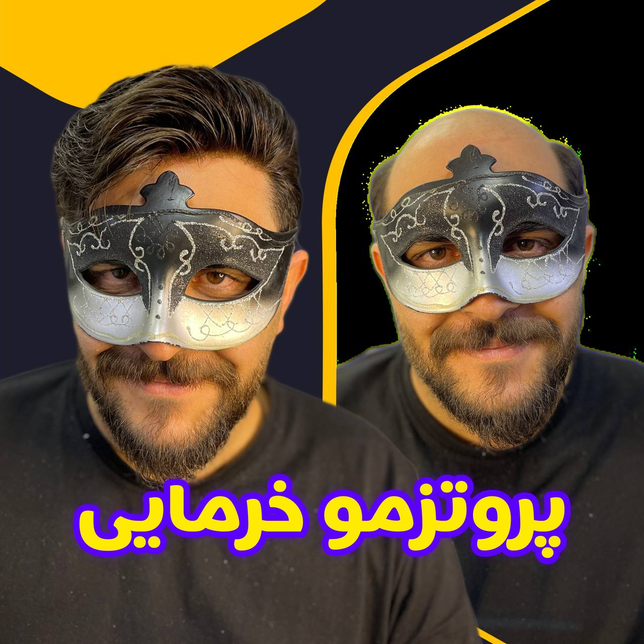 کلینیک تخصصی ایران مو