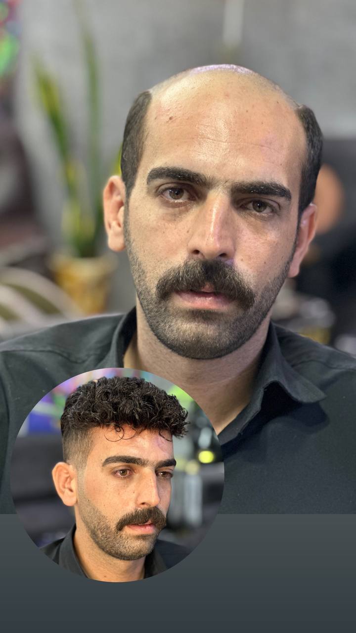 متخصص و مدرس پروتز مو سپاهان شهر