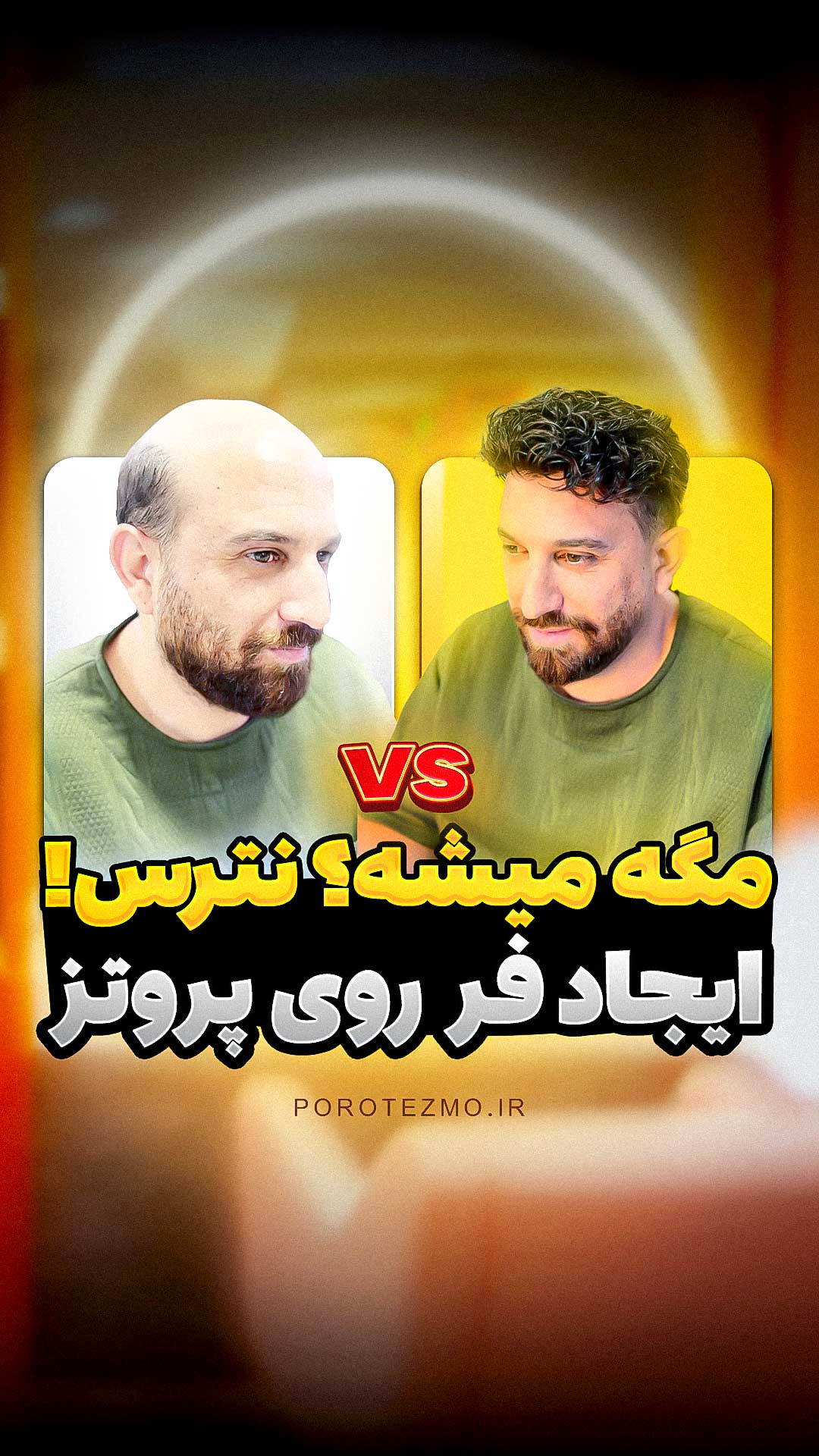 آموزش و متخصص پروتز مو در شهرضا