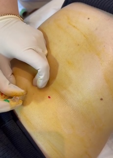 بهترین مرکز لاغری شهریار