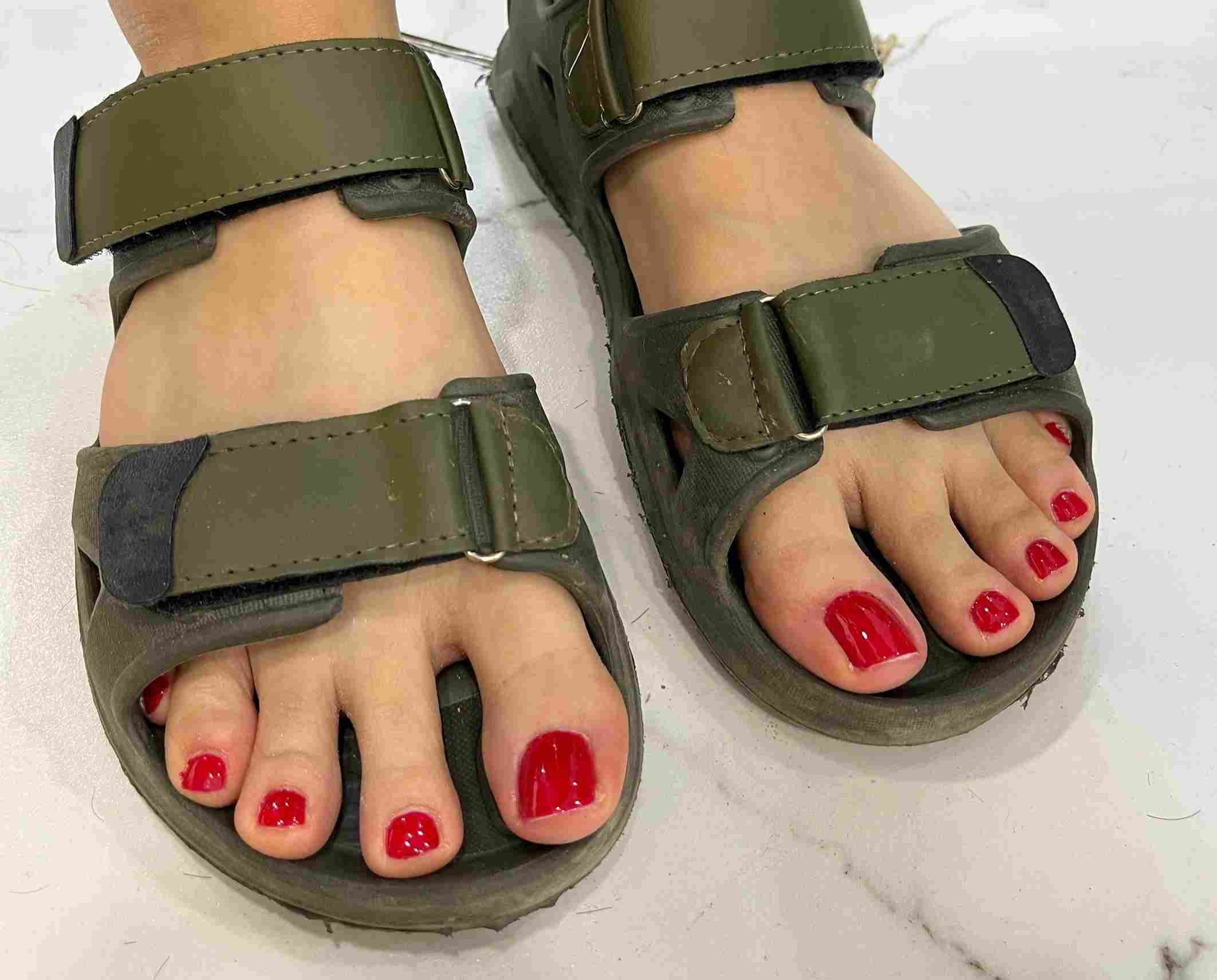 طرح کاشت ناخن پا در اصفهان
