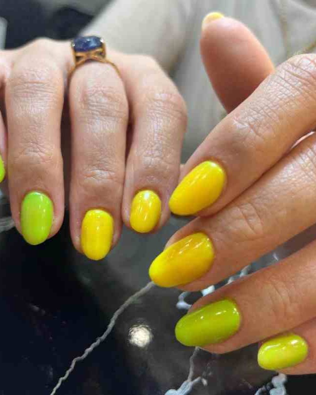 کاشت ناخن فسفری و زرد در اصفهان