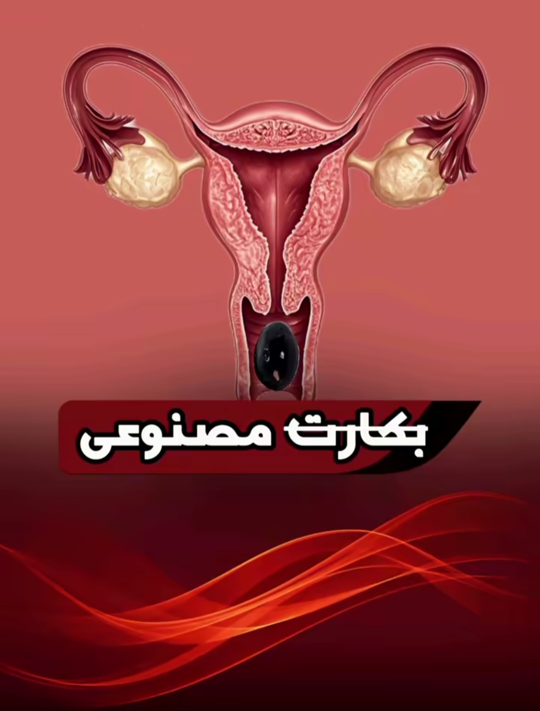 پرده بکارت مصنوعی