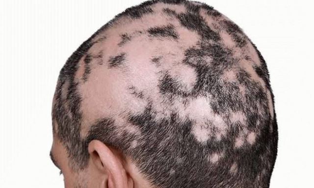 لیکن پلان پوستی