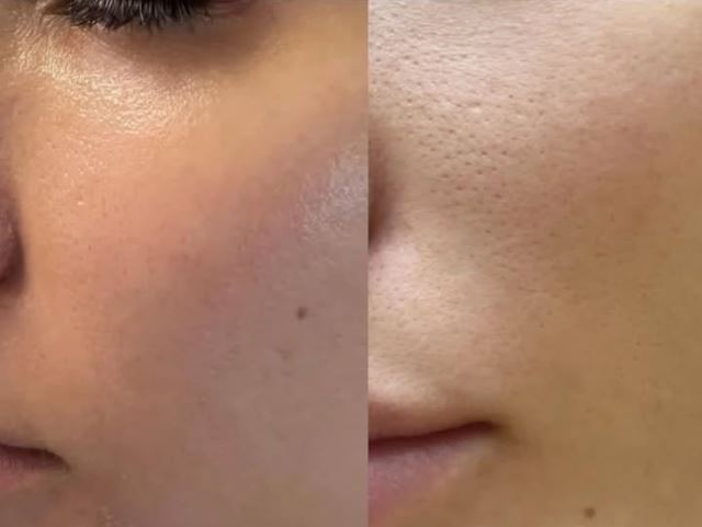 مرکز تخصصی زیبایی در اصفهان