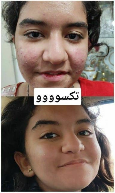 محصولات تکسو کرج 