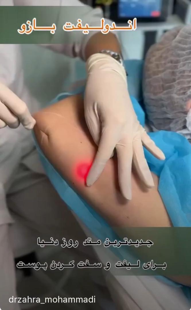 مرکز اندولیفت شهرک گلستان